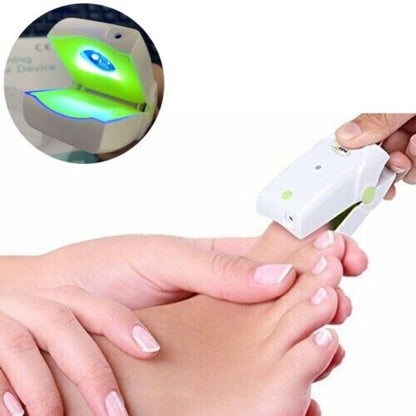 nail fungus removal treatment cleaning laser therapy device onychomycosis